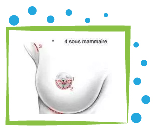 lifting mammaire prix tunisie