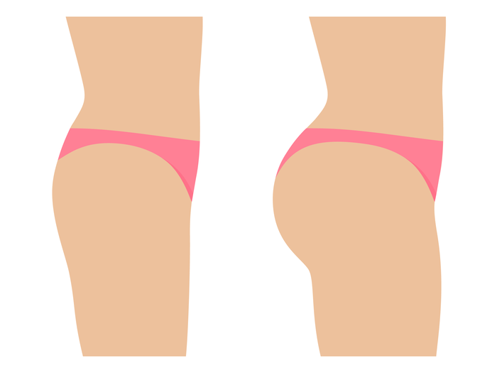 chirurgie esthétique des fesse chirurgie esthétique des fesse