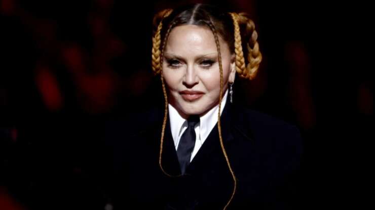 Madonna & chirurgie esthétique : choix personnel ou pression médiatique ?