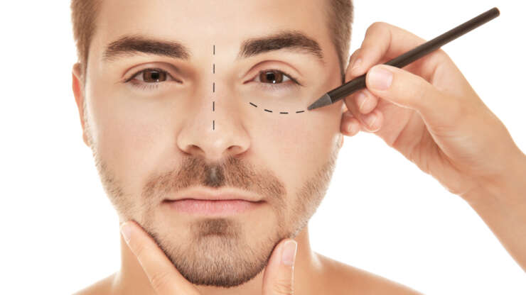 Julien Tanti avant chirurgie : est-ce une vérité ou un mensonge ?