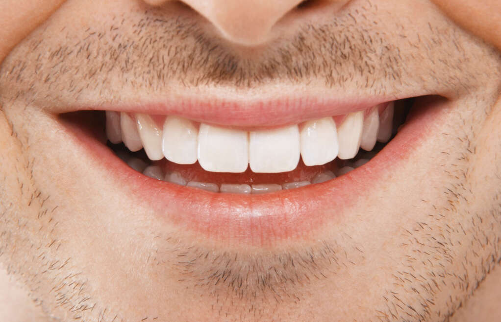 Dites adieu aux mauvaises positions dentaires grâce à l’alignement des dents !
