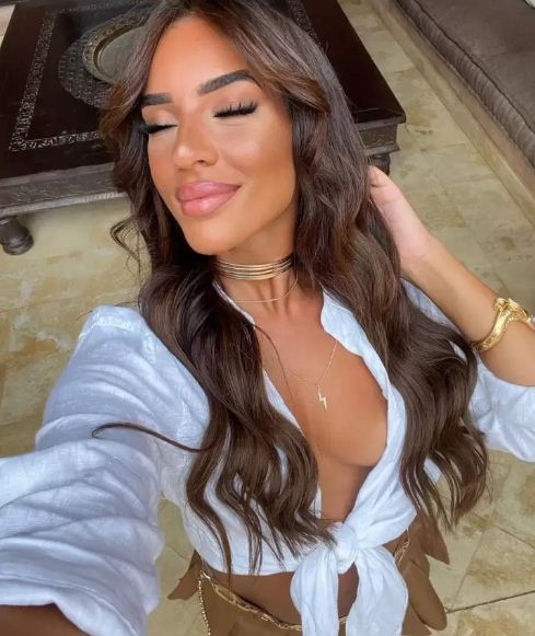 Marwa merazka avant après chirurgie levres