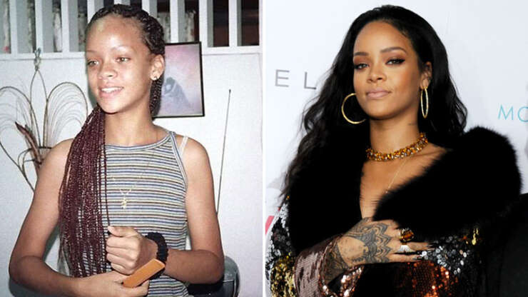 Rihanna avant la chirurgie