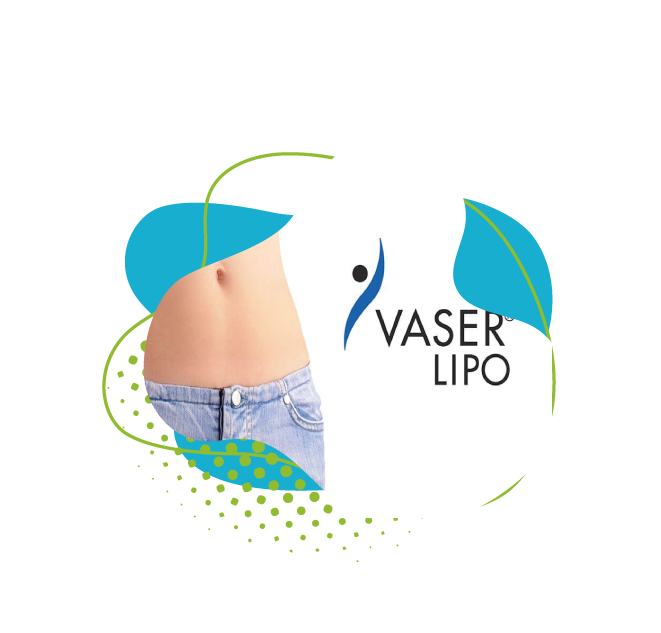 Liposuccion vaser : Liposuccion assistée par ultrasons