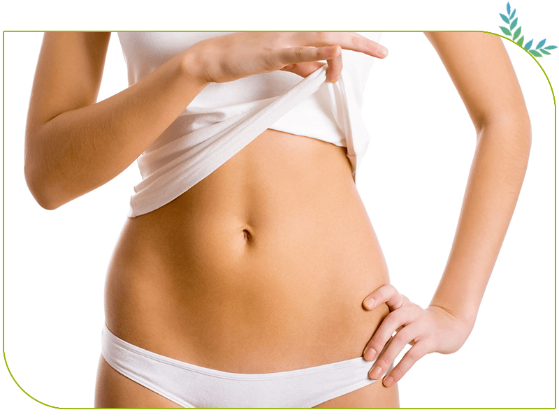 abdominoplastie nombril