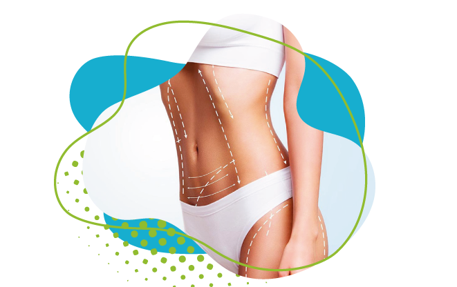 Bodylift complet : Quand et pourquoi associer cette intervention avec une liposuccion ?