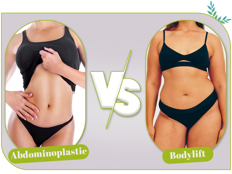 Bodylift ou abdominoplastie