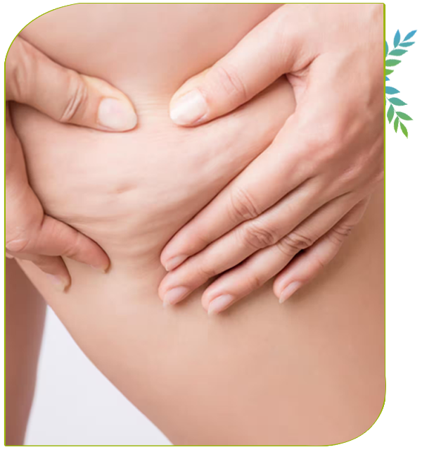 excès de peau cuisse