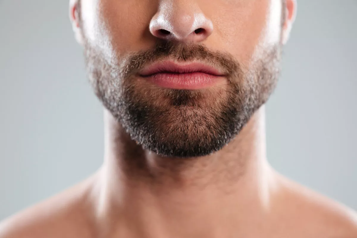 Bichectomie pour homme