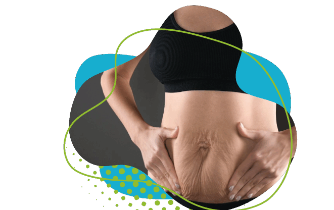 Comment Remédier à un Ventre Relâché: Solutions Chirurgicales et Non-Chirurgicales