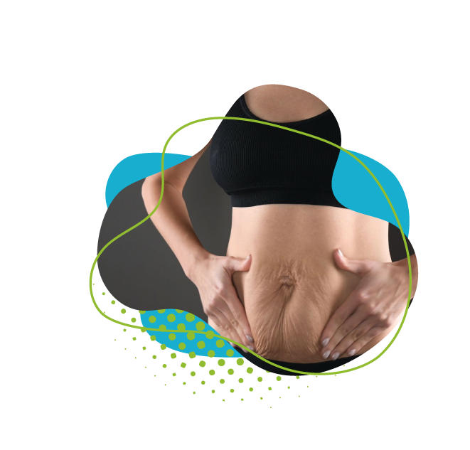 Comment Remédier à un Ventre Relâché: Solutions Chirurgicales et Non-Chirurgicales