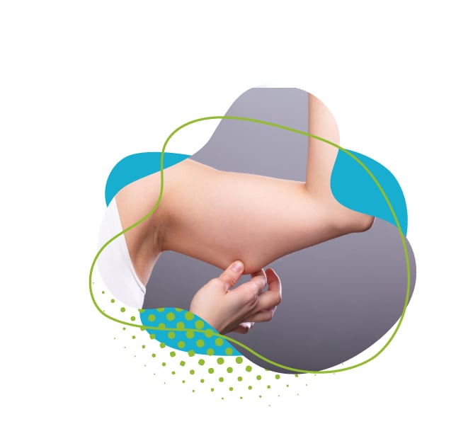 Liposuccion des bras et J-Plasma : la solution pour des bras fermes et toniques