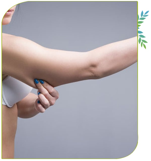 Liposuccion des bras 
