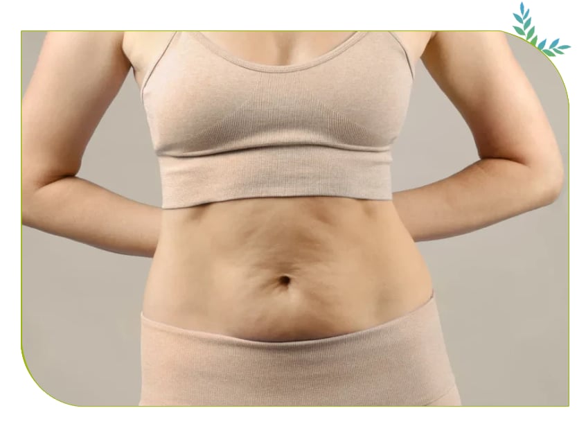 Abdominoplastie secondaire en tunisie