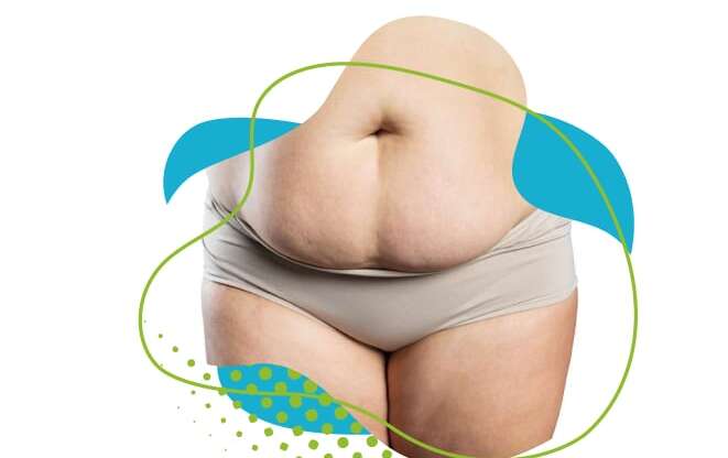 Abdominoplastie Secondaire : Guide Complet pour une Chirurgie de Révision Réussie